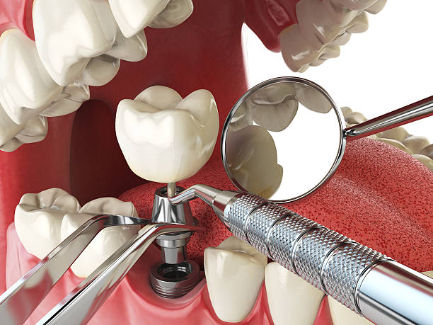 Best Emergency Gum Treatment in Myers Corner, NY